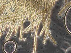 Mikroalgen der Gattung Trichodesmium: immer wieder in den kanarischen Gewässern gesichtet.